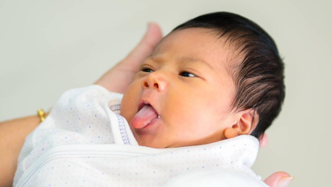 Penyebab Lidah Bayi Berwarna Putih